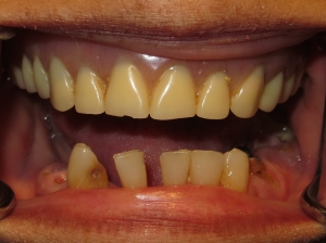 Smile Gallery