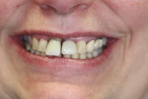 Smile Gallery