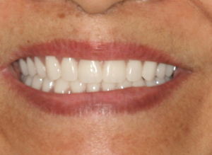 Smile Gallery
