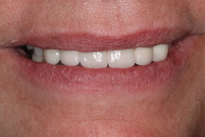 Smile Gallery