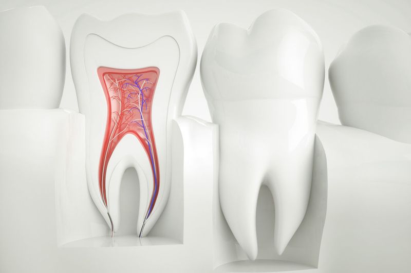 Root Canals