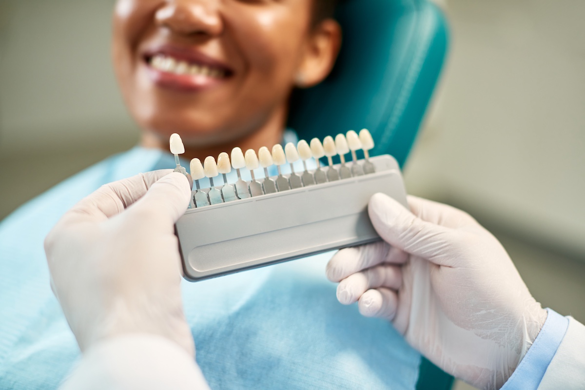 Dental Veneers