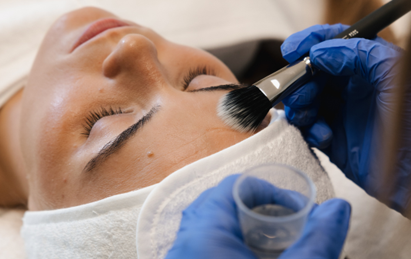 Hjúkrunarfræðingur framkvæmir ávaxtasýrumeðferð með SkinCeuticals sýru sem hreinsar og frískar upp húð. Öflug meðferð fyrir slétta og ljómandi húð. Bókaðu faglega meðferð.