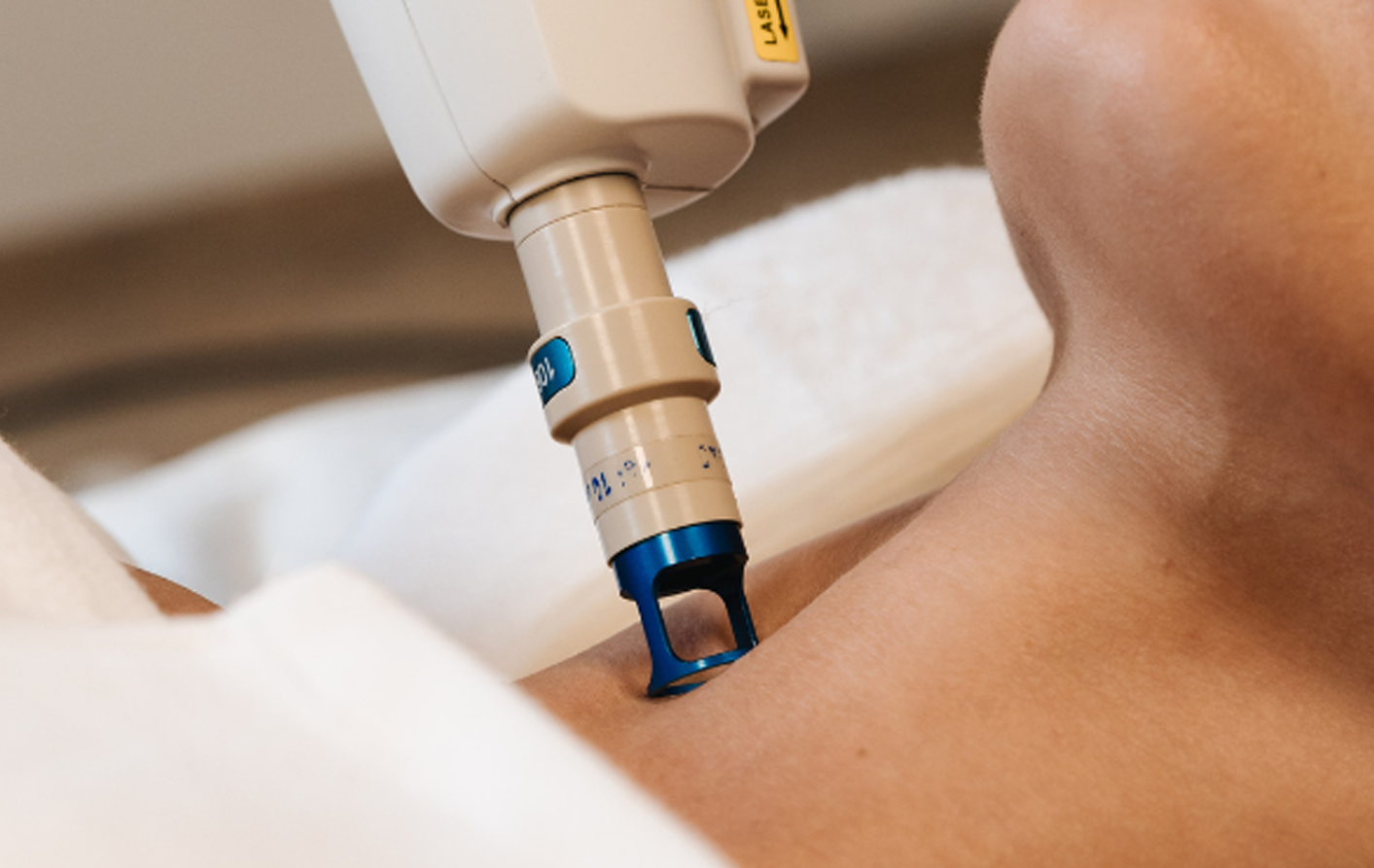 Laserlyfting vinnur djúpt í undirlagi húðar til að styrkja, þétta og lyfta húð á náttúrulegan hátt með nýjustu tækni.