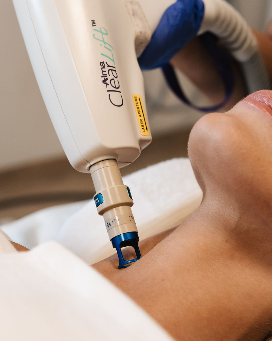 Nærmynd af konu í Laserlyfting á hálsi hjá Húðfegrun í Reykjavík. Meðferðin styrkir og þéttir húð á öruggan hátt með nýjustu lasertækni. Bókaðu faglega meðferð hjá okkar hjúkrunarfræðingum.