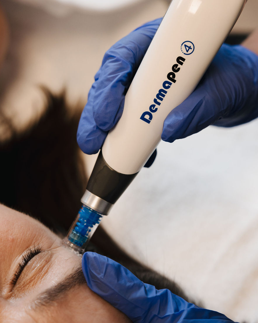 Nærmynd af konu í Dermapen Microneedling meðferð á augnsvæði hjá Húðfegrun. Hjúkrunarfræðingur framkvæmir meðferð með nýjustu tækni til að örva kollagen og endurnýja húð. Bókaðu meðferð í Reykjavík.