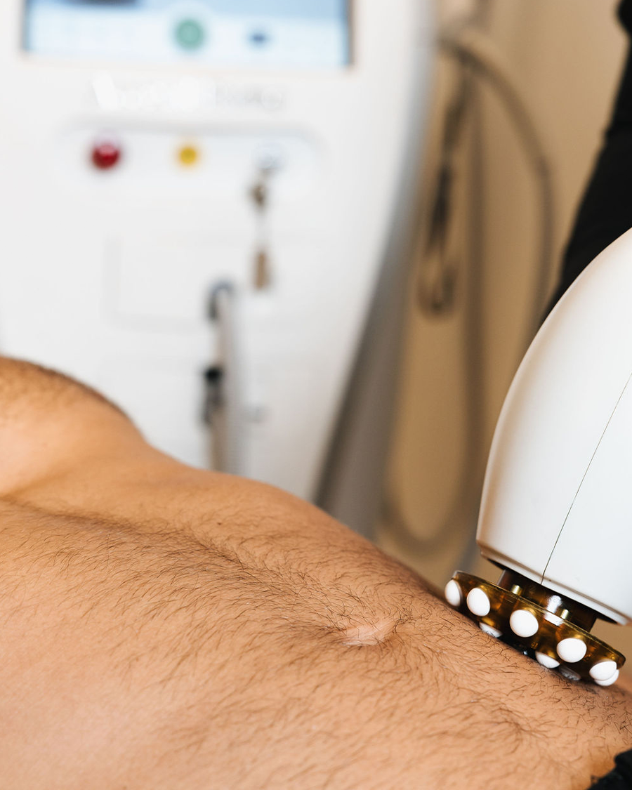 Karl liggur í rólegu klínísku umhverfi Húðfegrunar á meðan hjúkrunarfræðingur framkvæmir húðþéttingu með nýjustu laser- og RF-tækni. Meðferð sem styrkir og jafnar húð á öruggan hátt. Bókaðu faglega meðferð í Reykjavík.