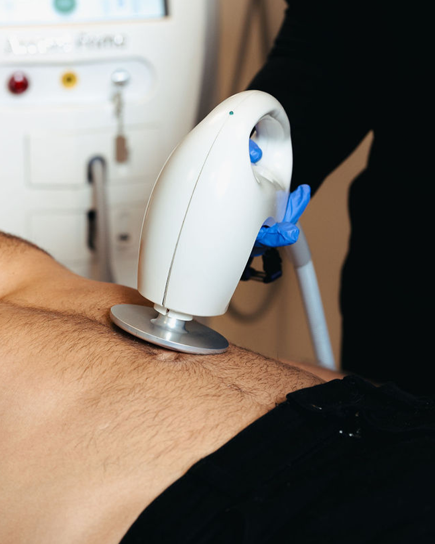 Nærmynd af Ultrasound tæki notuðu við fitueyðingu á klíníku Húðfegrunar. Meðferðin eyðir fitufrumum á náttúrulegan hátt án skurðaðgerðar og skilar sýnilegum árangri. Bókaðu tíma hjá hjúkrunarfræðingi í Reykjavík.