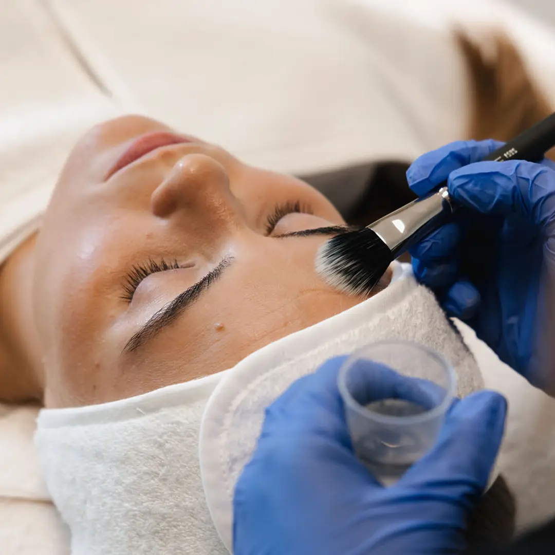 Hjúkrunarfræðingur framkvæmir ávaxtasýrumeðferð með SkinCeuticals sýru sem hreinsar og frískar upp húð. Öflug meðferð fyrir slétta og ljómandi húð. Bókaðu faglega meðferð.