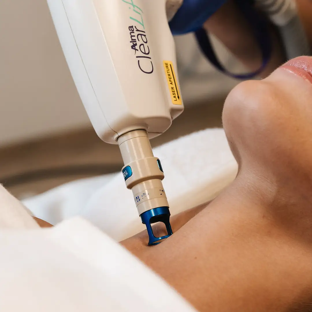 Nærmynd af konu í Laserlyfting á hálsi hjá Húðfegrun í Reykjavík. Meðferðin styrkir og þéttir húð á öruggan hátt með nýjustu lasertækni. Bókaðu faglega meðferð hjá okkar hjúkrunarfræðingum.