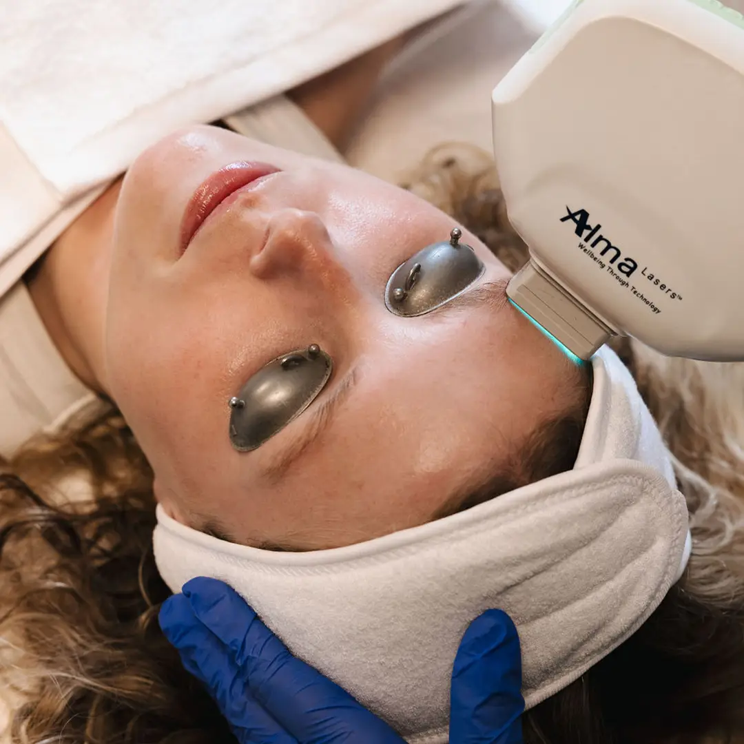 Nærmynd af konu í lasermeðferð hjá Húðfegrun í Reykjavík. Hjúkrunarfræðingur framkvæmir meðferð með nýjustu laser­tækni til að draga úr litabreytingum og jafna húðlit. Örugg, fagleg meðferð – bókaðu tíma í dag.