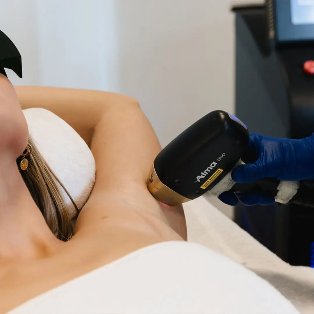 Hjúkrunarfræðingur framkvæmir laser háreyðingu sem fjarlægir óæskilegan hárvöxt á andliti og líkama varanlega.