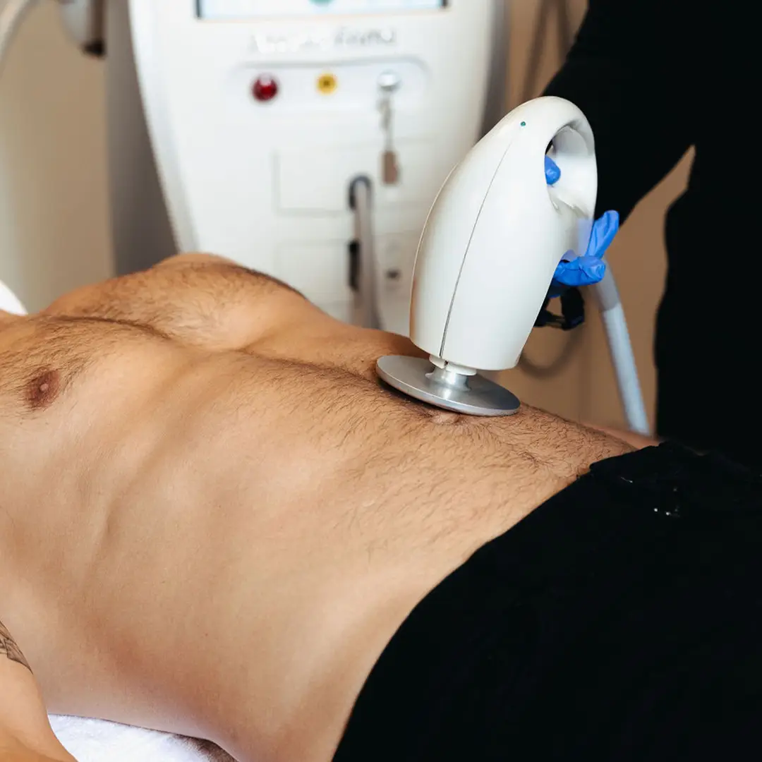 Fitueyðing með ultrasound tækni sem eyðir fitu á öruggan og sársaukalausan hátt með nýjustu tækni frá Húðfegrun.