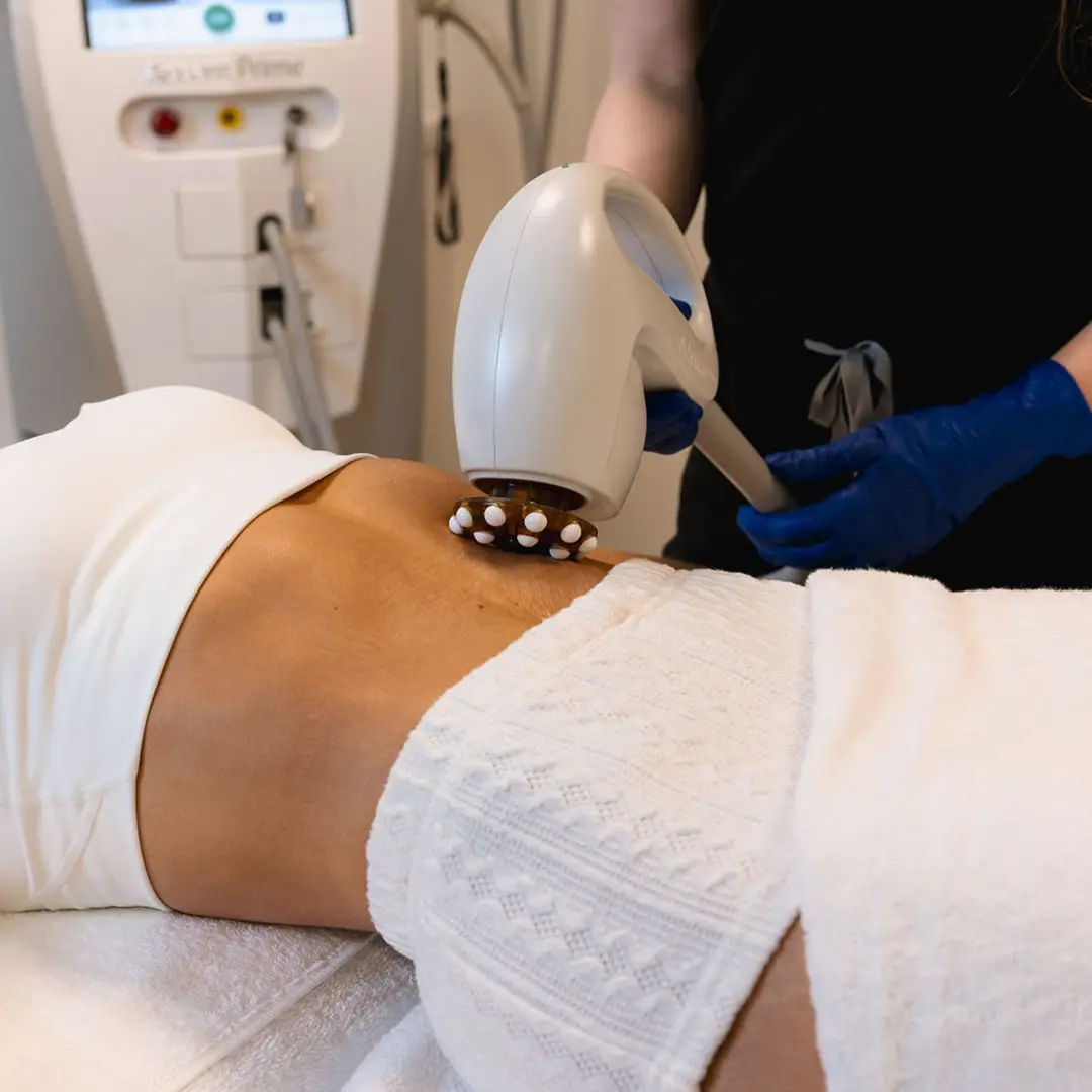 Hjúkrunarfræðingur hjá Húðfegrun framkvæmir húðþéttingu á maga og mitti í klínísku umhverfi í Reykjavík. Sársaukalaus meðferð með nýjustu RF tækni sem styrkir og þéttir húð. Bókaðu faglega meðferð í dag.