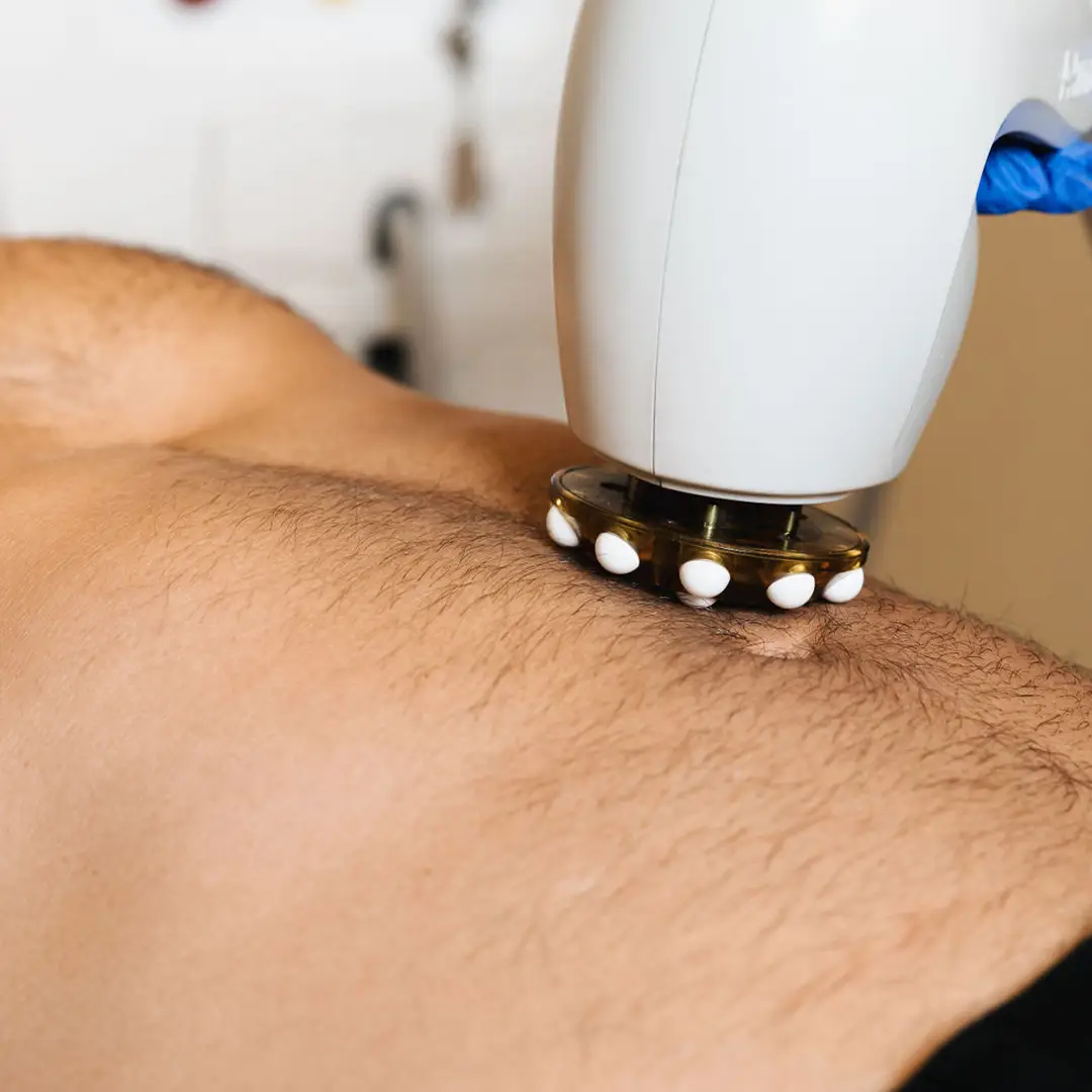 Karl liggur í rólegu klínísku umhverfi Húðfegrunar á meðan hjúkrunarfræðingur framkvæmir húðþéttingu með nýjustu laser- og RF-tækni. Meðferð sem styrkir og jafnar húð á öruggan hátt. Bókaðu faglega meðferð í Reykjavík.