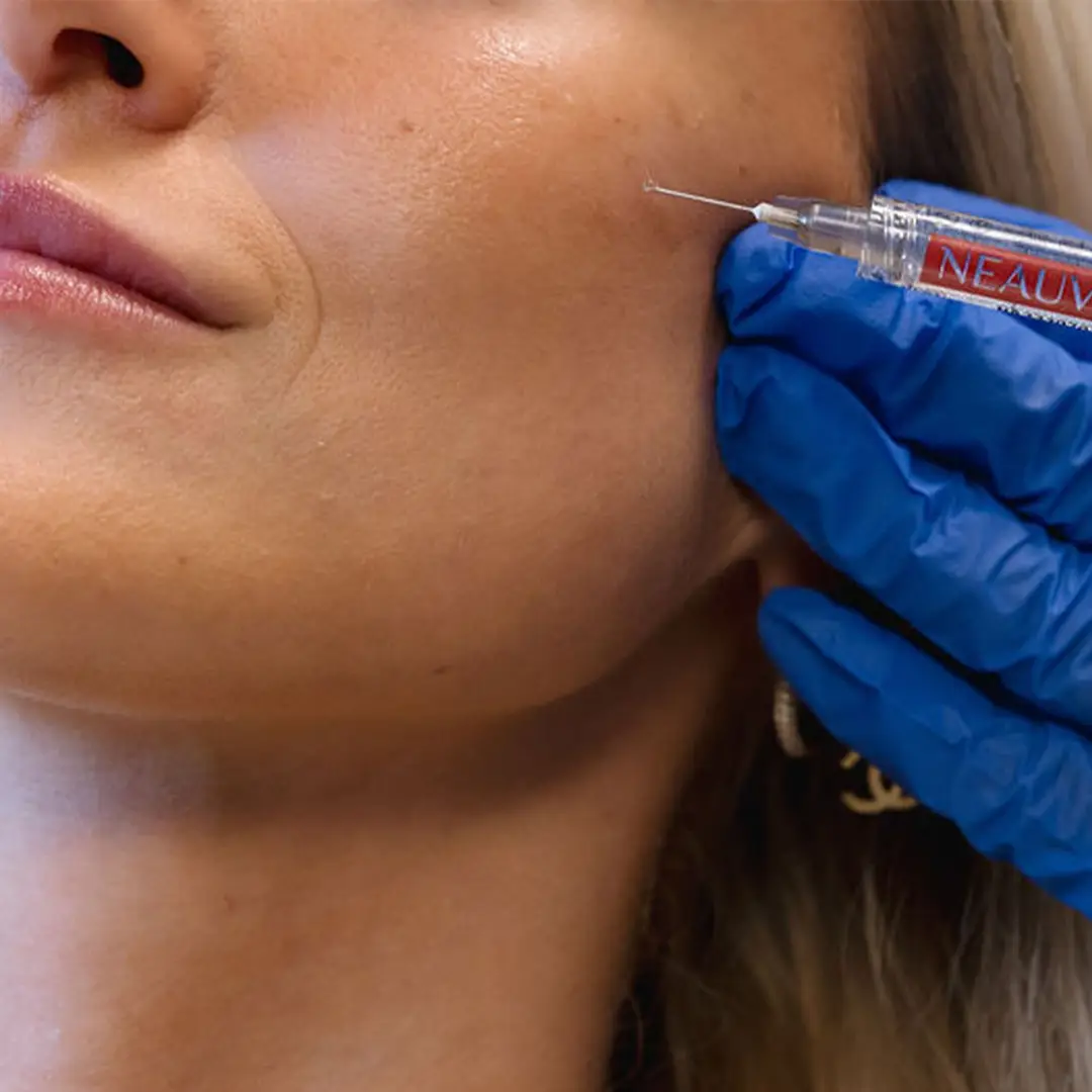 Mesotherapy meðferð sem sprautar Hyaluronic sýru og örvar kollagenframleiðslu fyrir þéttari, stinnari og rakameiri húð.