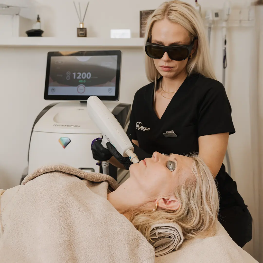 Laserlyfting vinnur djúpt í undirlagi húðar til að styrkja, þétta og lyfta húð á náttúrulegan hátt með nýjustu tækni.