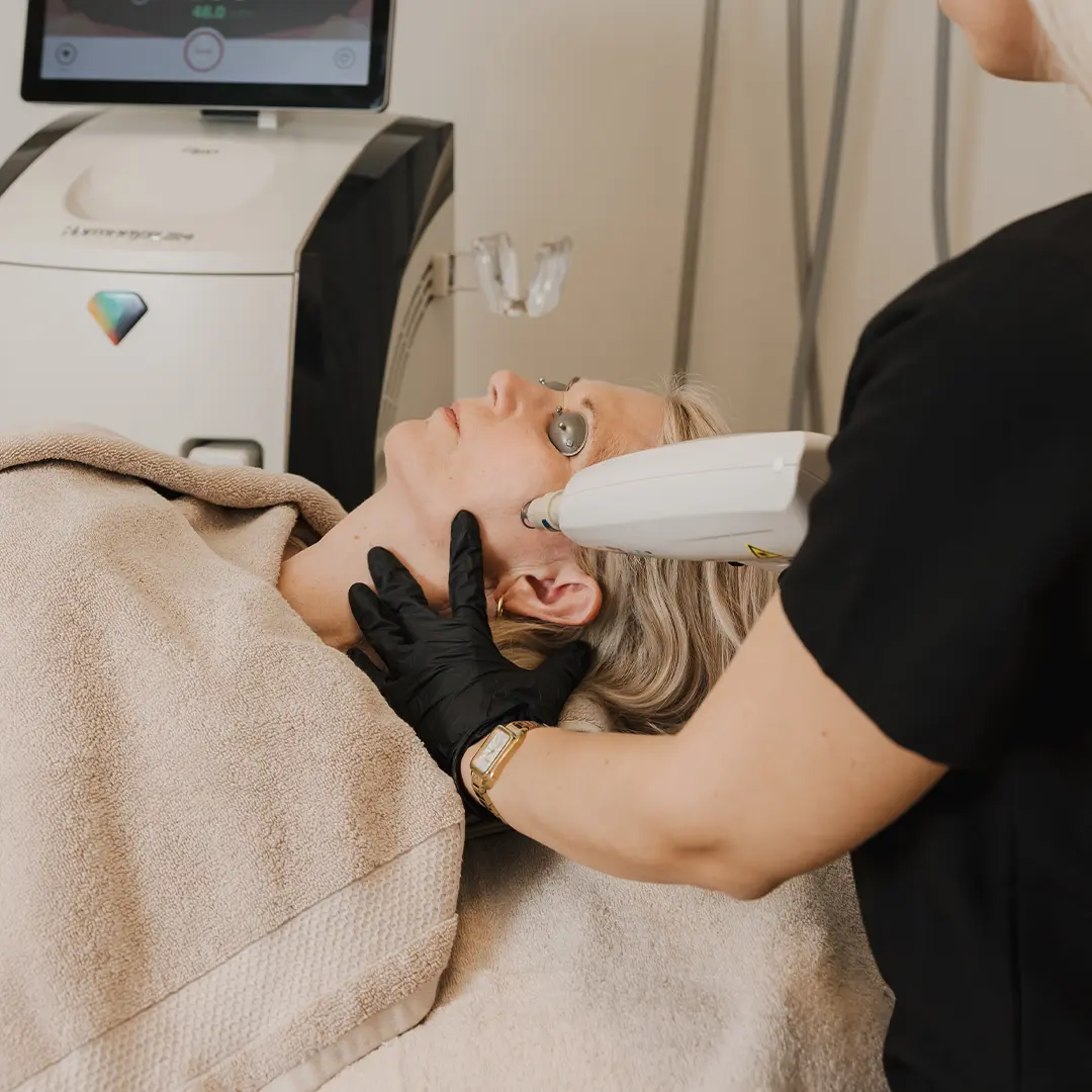 Nærmynd af konu í laserlyftingu á augnsvæði. Fullkomin viðbót við Hollywood Glow fyrir lengri varanleika og aukna húðþéttleika. Húðfegrun býður nýjustu lasermeðferðir – bókaðu tíma á klíníkunni í Reykjavík.
