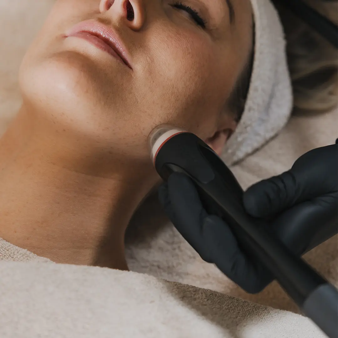 Nærmynd af Dermaclear-meðferð á kinnum skjólstæðings sem miðar að því að jafna húðáferð og veita aukinn ljóma. Skjólstæðingur liggur afslappaður með lokuð augu á meðan meðferðin fer fram af fagmenntuðum hjúkrunarfræðingi.