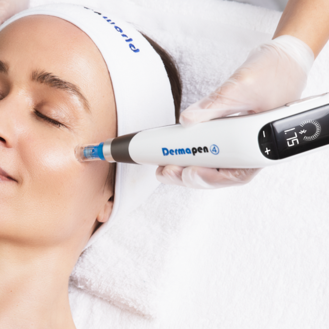 Dermapen microneedling meðferð framkvæmd hjá Húðfegrun í Reykjavík til að örva kollagenframleiðslu og endurnýjun húðarinnar.