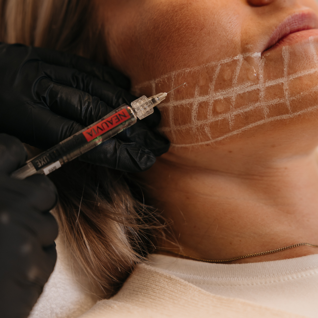 Kona fær Hyaluronic Booster meðferð hjá Húðfegrun – fullkomið viðbót við húðþéttingu til að auka raka, styrk og þéttleika húðar. Framkvæmd af faglærðum hjúkrunarfræðingum í klínísku umhverfi. Bókaðu tíma í dag.