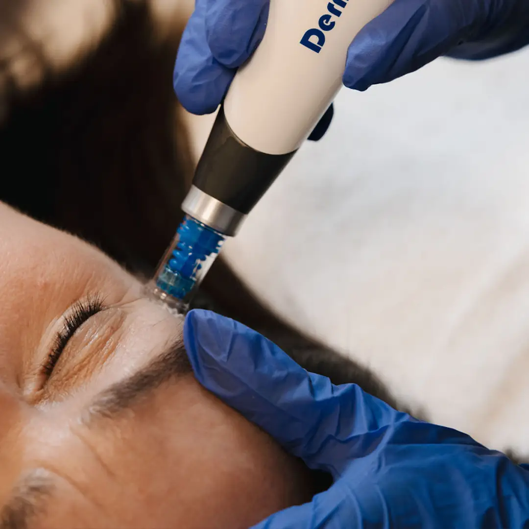 Hjúkrunarfræðingur framkvæmir augnlyftingu á húðklíníku Húðfegrunar í Reykjavík til að lyfta augnlokum og þétta húð á augnsvæði á náttúrulegan hátt.