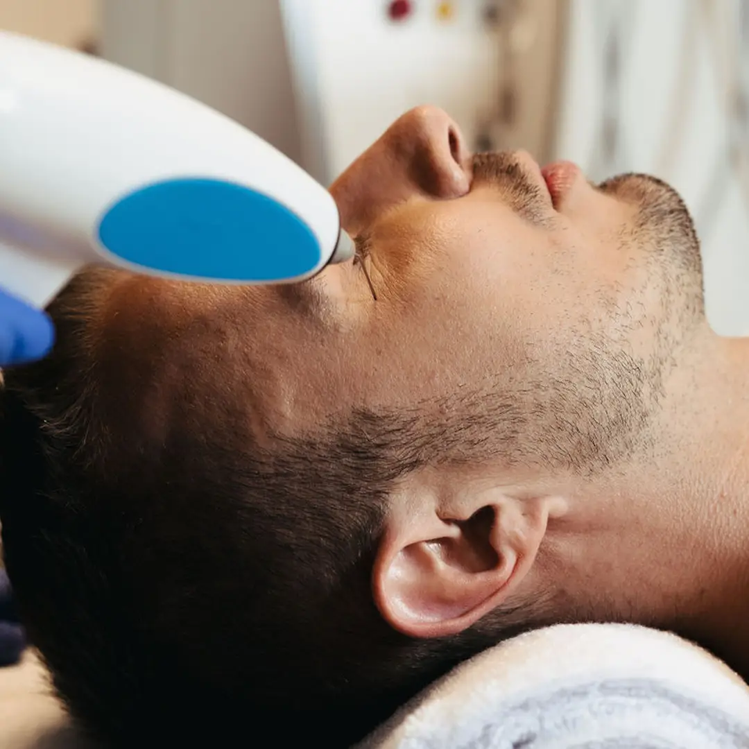 Hjúkrunarfræðingur framkvæmir augnlyftingu á húðklíníku Húðfegrunar í Reykjavík til að lyfta augnlokum og þétta húð á augnsvæði á náttúrulegan hátt.