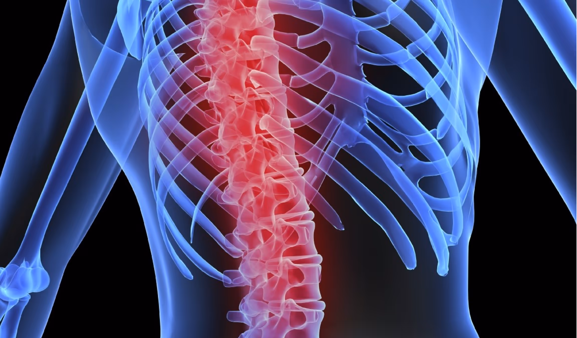 X-ray style image showing ribs and spine highlighted in red to indicate pain or inflammation in the thoracic spine area.