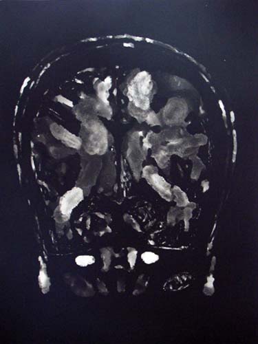 Création Artistique et imagerie médicale 37