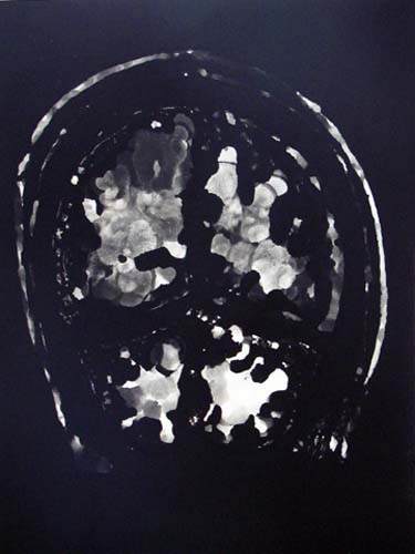 Création Artistique et imagerie médicale 5