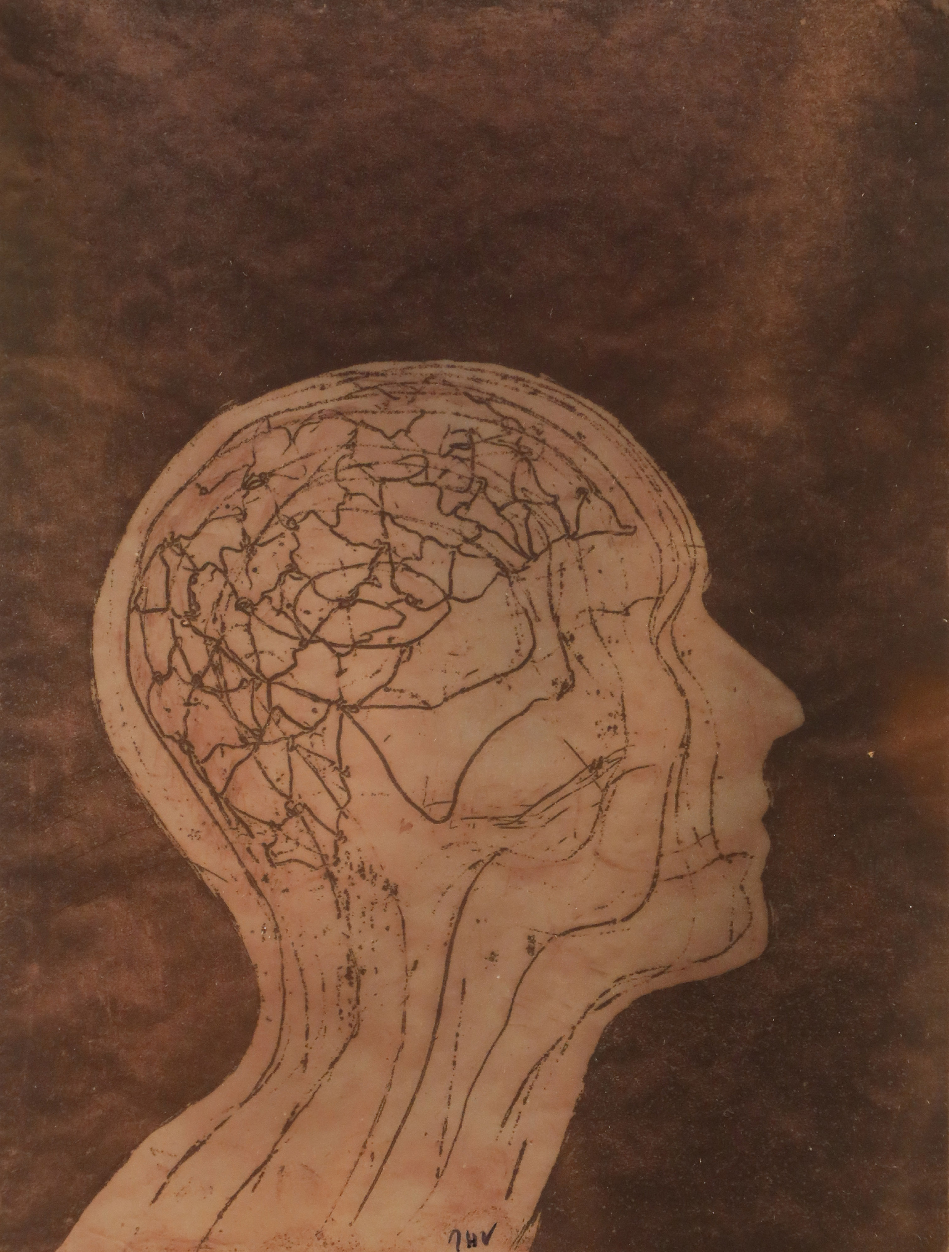 Création Artistique et imagerie médicale 10