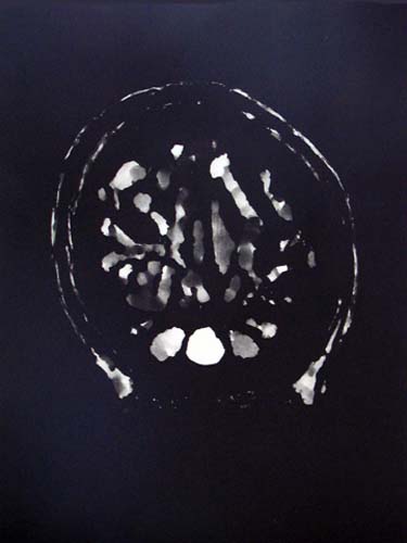 Création Artistique et imagerie médicale 6