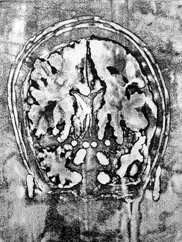 Création Artistique et imagerie médicale 19
