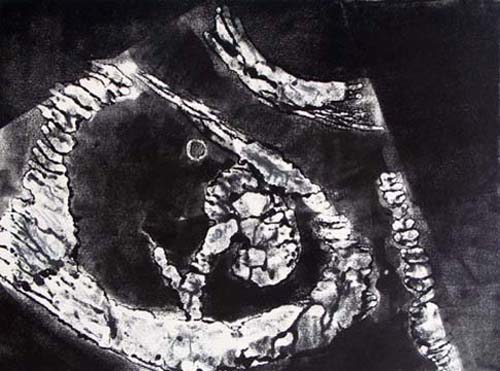 Création Artistique et imagerie médicale 14
