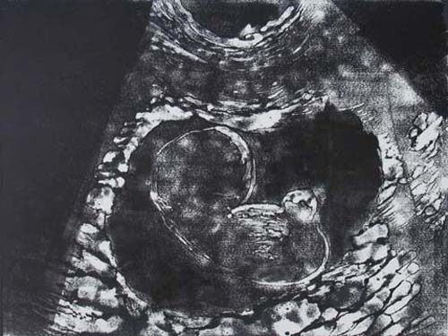 Création Artistique et imagerie médicale 15