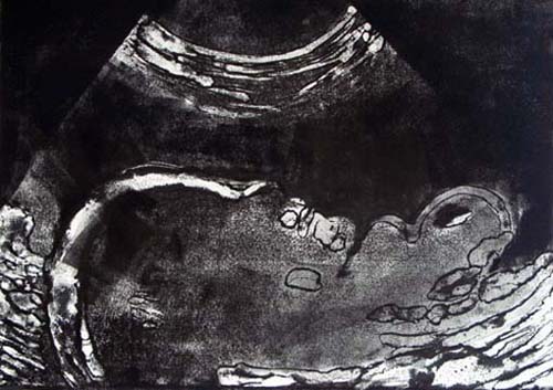 Création Artistique et imagerie médicale 17