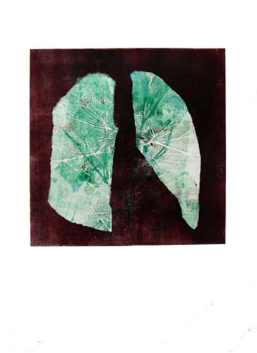 Création Artistique et imagerie médicale 26