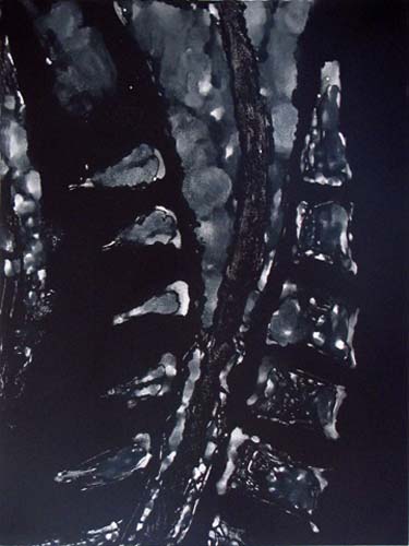 Création Artistique et imagerie médicale 23