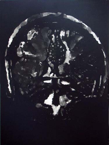 Création Artistique et imagerie médicale 33
