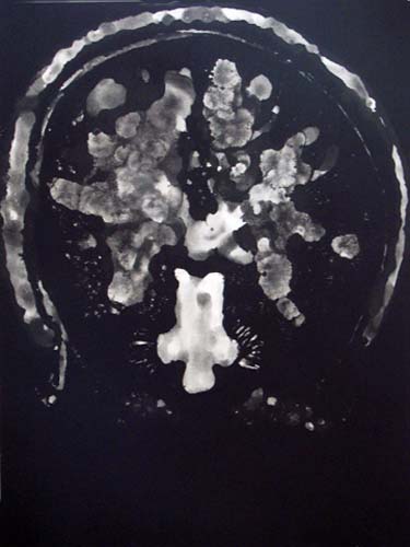 Création Artistique et imagerie médicale 34