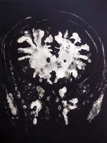 Création Artistique et imagerie médicale 30