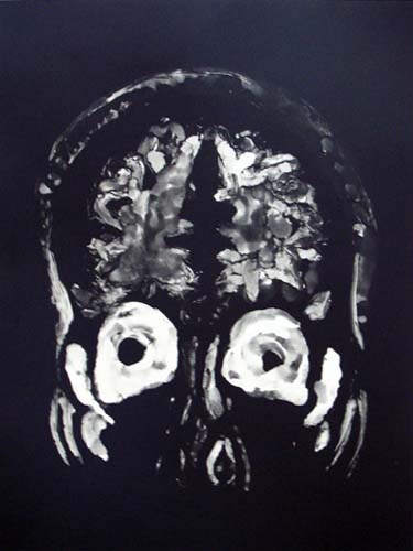 Création Artistique et imagerie médicale 35