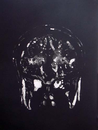 Création Artistique et imagerie médicale 29