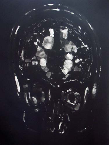 Création Artistique et imagerie médicale 32