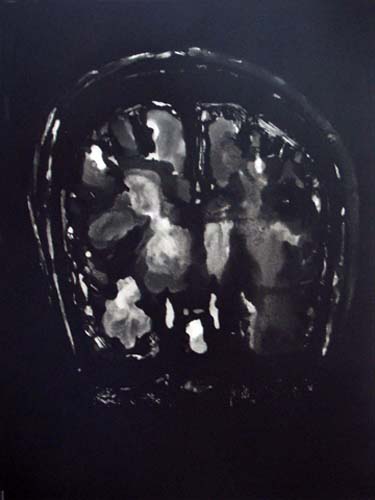 Création Artistique et imagerie médicale 31