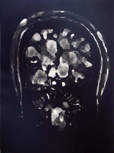 Création Artistique et imagerie médicale 36