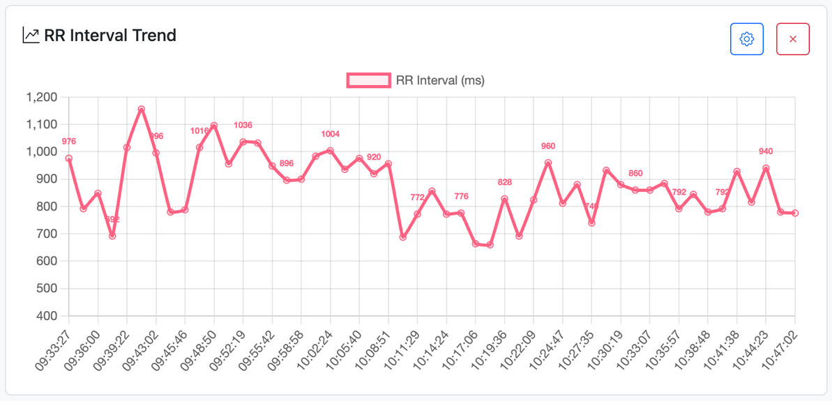 PR Interval chart widget