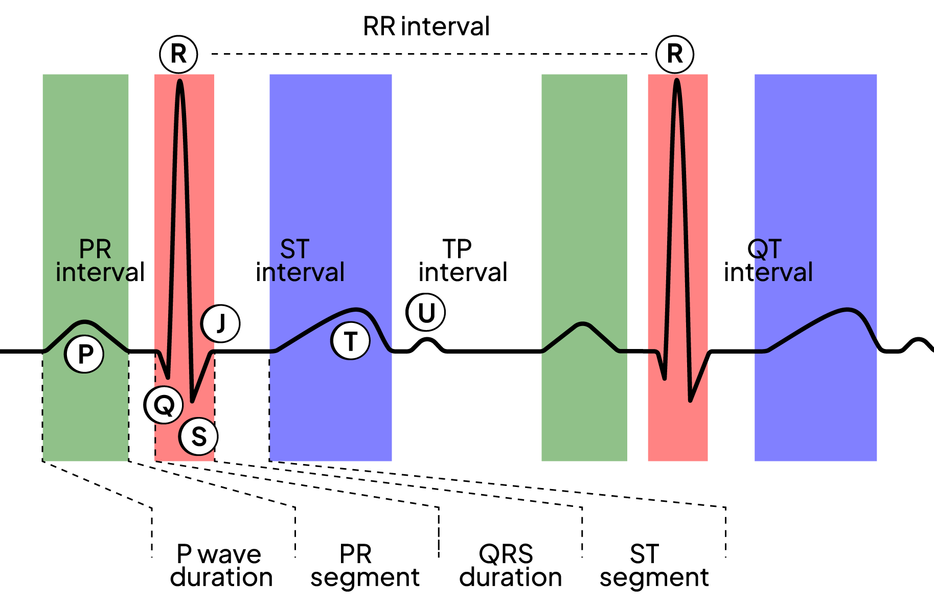Diagram of two ECG beats with the P, Q, R, S, T, J and U points labelled and the PR interval, ST interval, TP interval, QT interval, RR interval, P wave duration, PR segment, QRS duration and ST segment marked