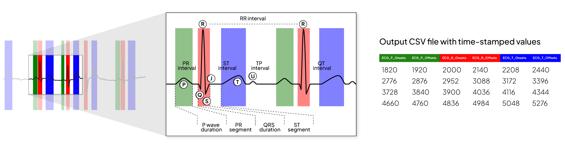 Diagram of an ECG waveform with the PR, ST, TP and QT intervals and the RR interval marked, next to a table of time-stamped output values for the P, R and T onsets and offsets