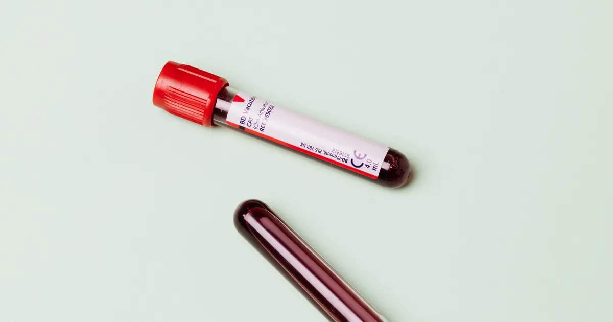 Hormone Testing for Women: DUTCH vs Blood, and When to Test